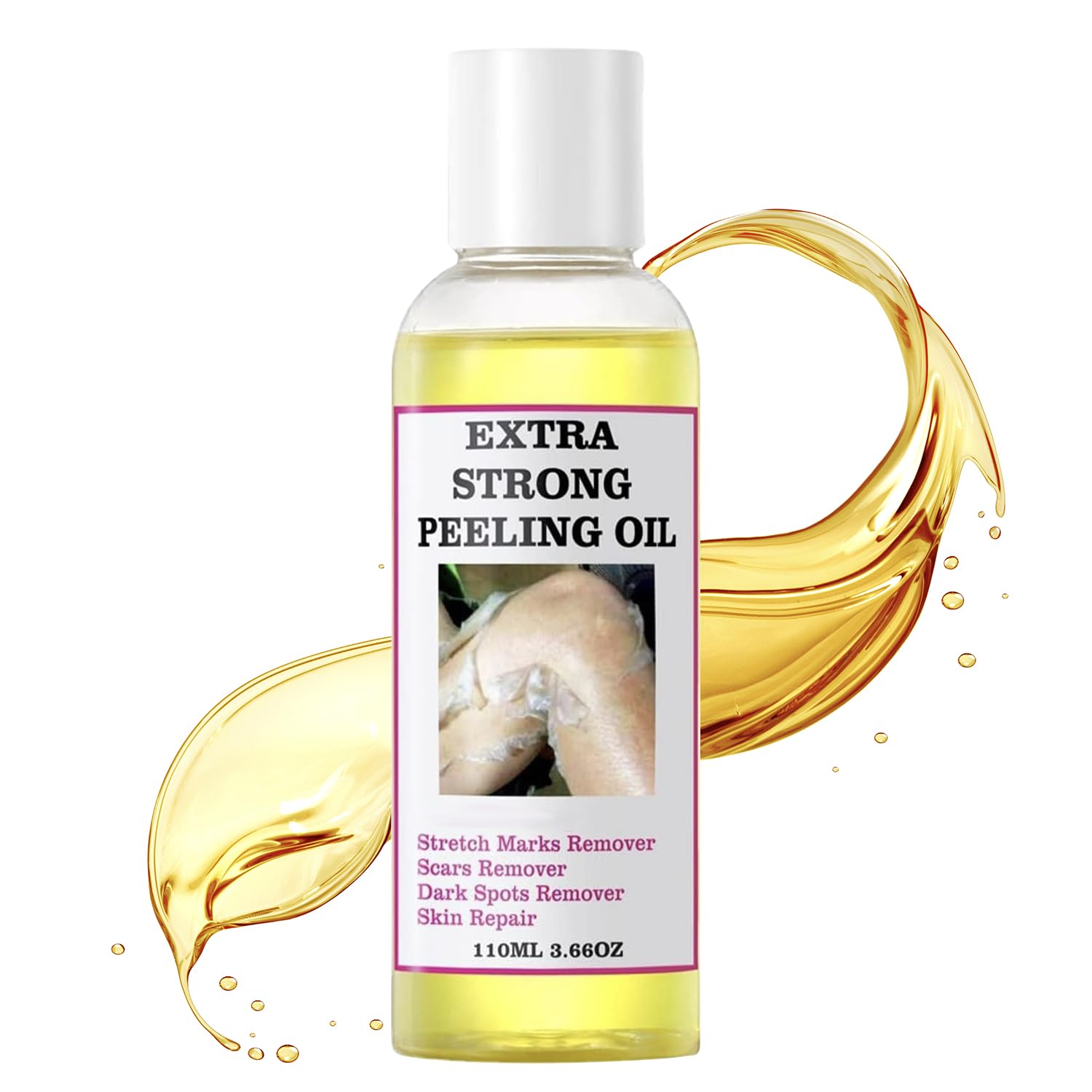 Chemical Peel for Face - Peeling Oil for Facial & Body Exfolianting with 16% Salicylic Acid - Dead Skin Remover with Gentle Formula for All Skin Type - 110mL(3.66OZ)