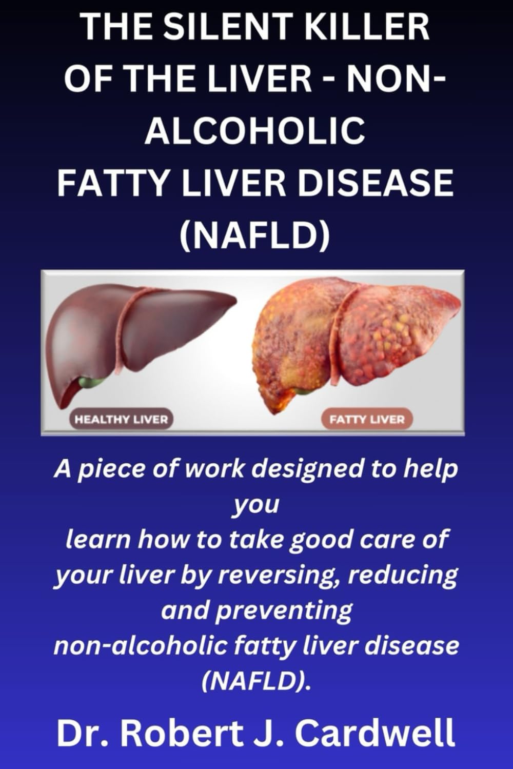 THE SILENT KILLER OF THE LIVER - NON-ALCOHOLIC FATTY LIVER DISEASE: a piece of work designed to help you learn how to take good care of your liver ... (NAFLD) (Exploring critical healthcare books)