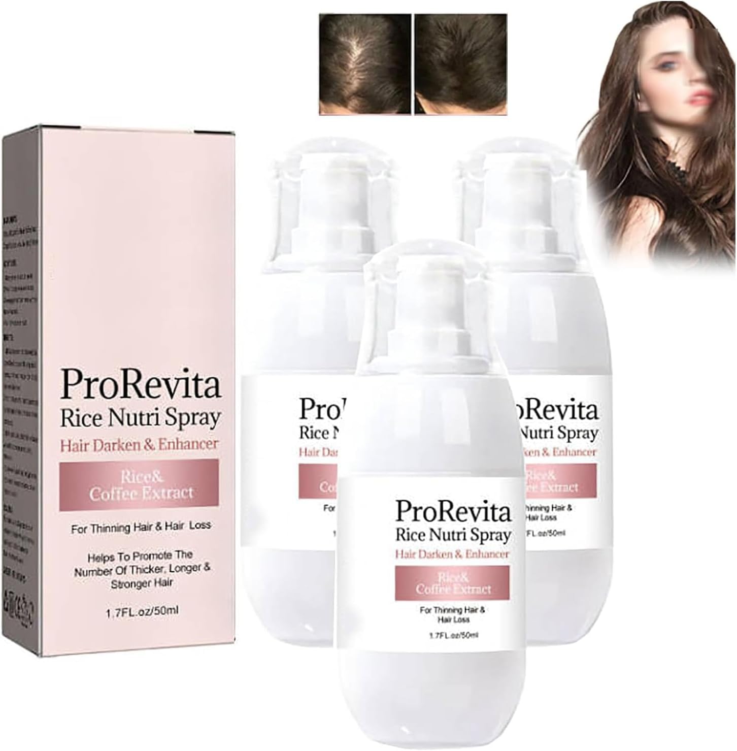 Zephta H-Regrow 2.0 - Zephta Hair Regrowth, H-Regrow 2.0, ProRevita Rice Nutri Spray, Hair Helper Spray, Hair Care Spray for Thinning Hair & Hair Loss, For All Hair Types (3PC)