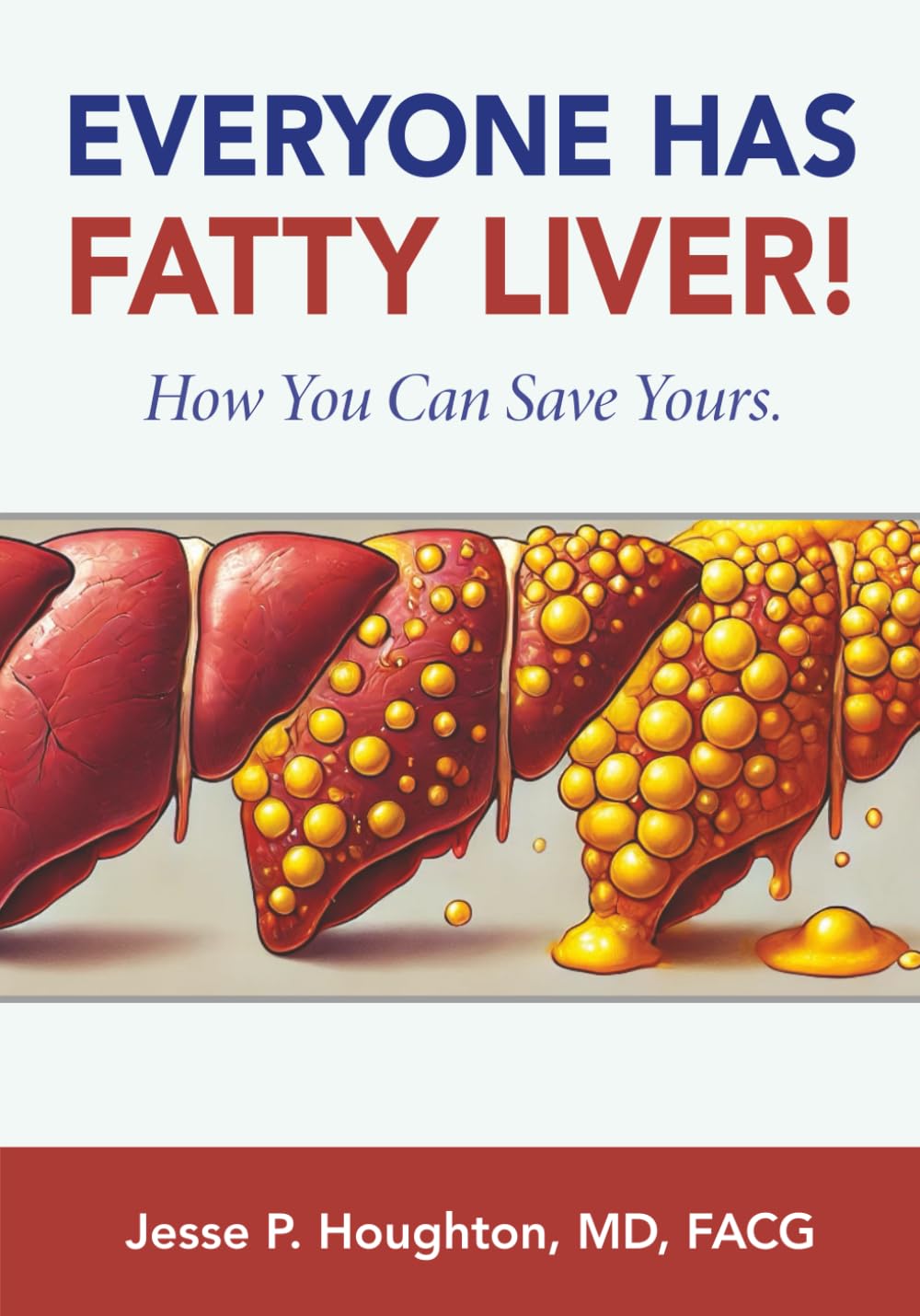 EVERYONE HAS FATTY LIVER!: How You Can Save Yours.