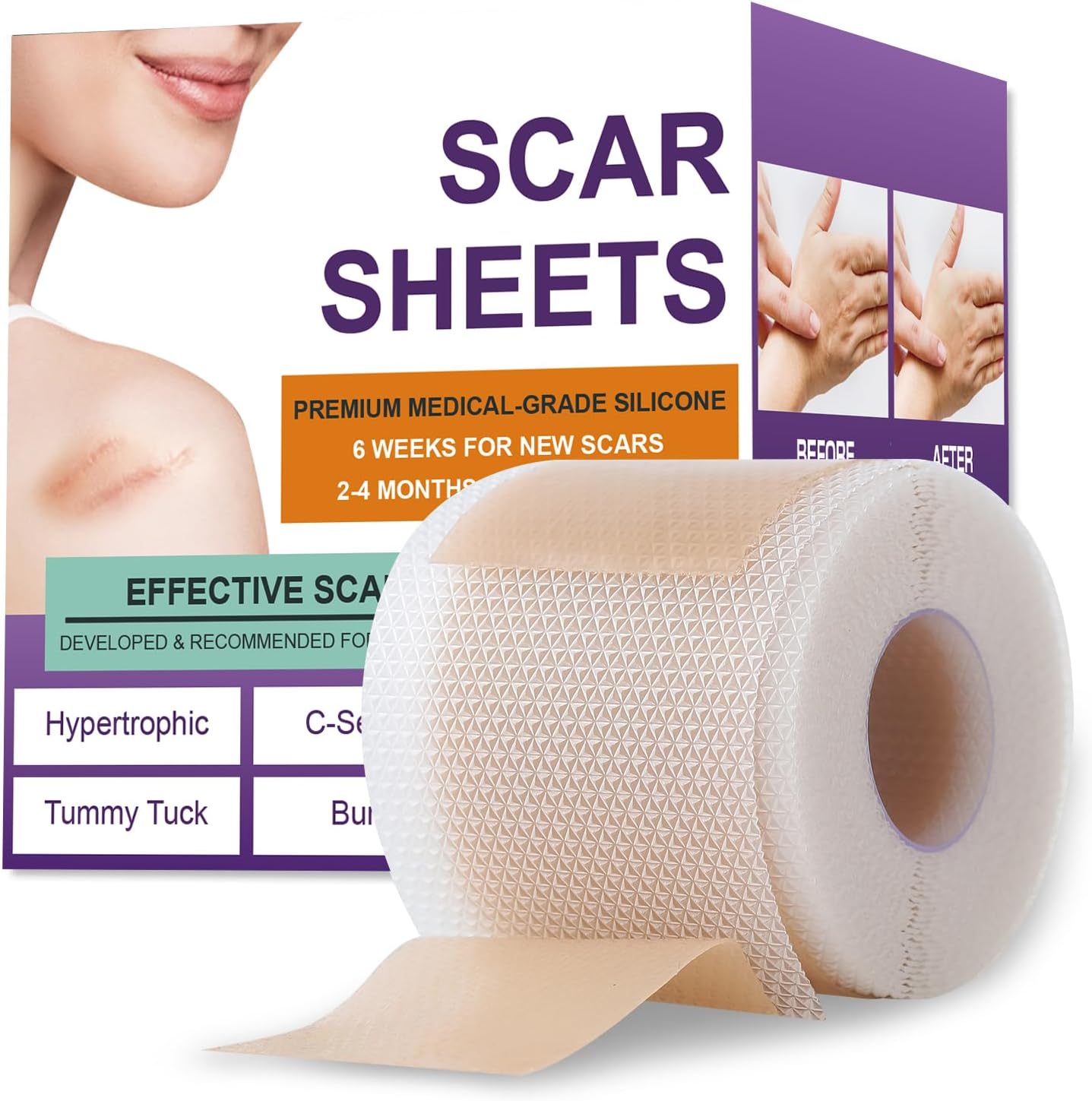 Psecici Silicone Scar Tape for Surgical Scars,Extra Long Scar Sheets for C-Section, Tummy Tuck, Keloid, and Surgical Scars - Reusable Medical Grade Silicone Scar Tape