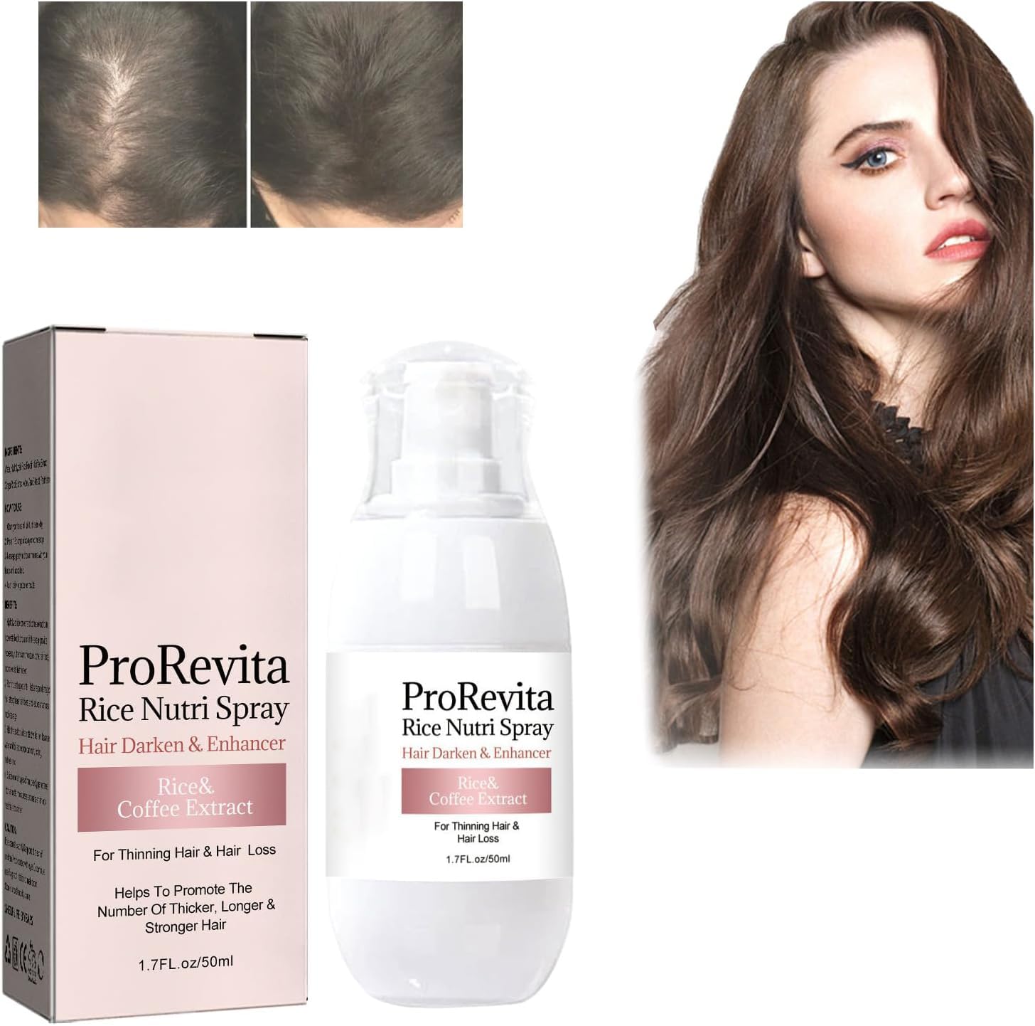 Zephta H-Regrow 2.0 - Zephta Hair Regrowth, H-Regrow 2.0, ProRevita Rice Nutri Spray, Hair Helper Spray, Hair Care Spray for Thinning Hair & Hair Loss, For All Hair Types (1PC)