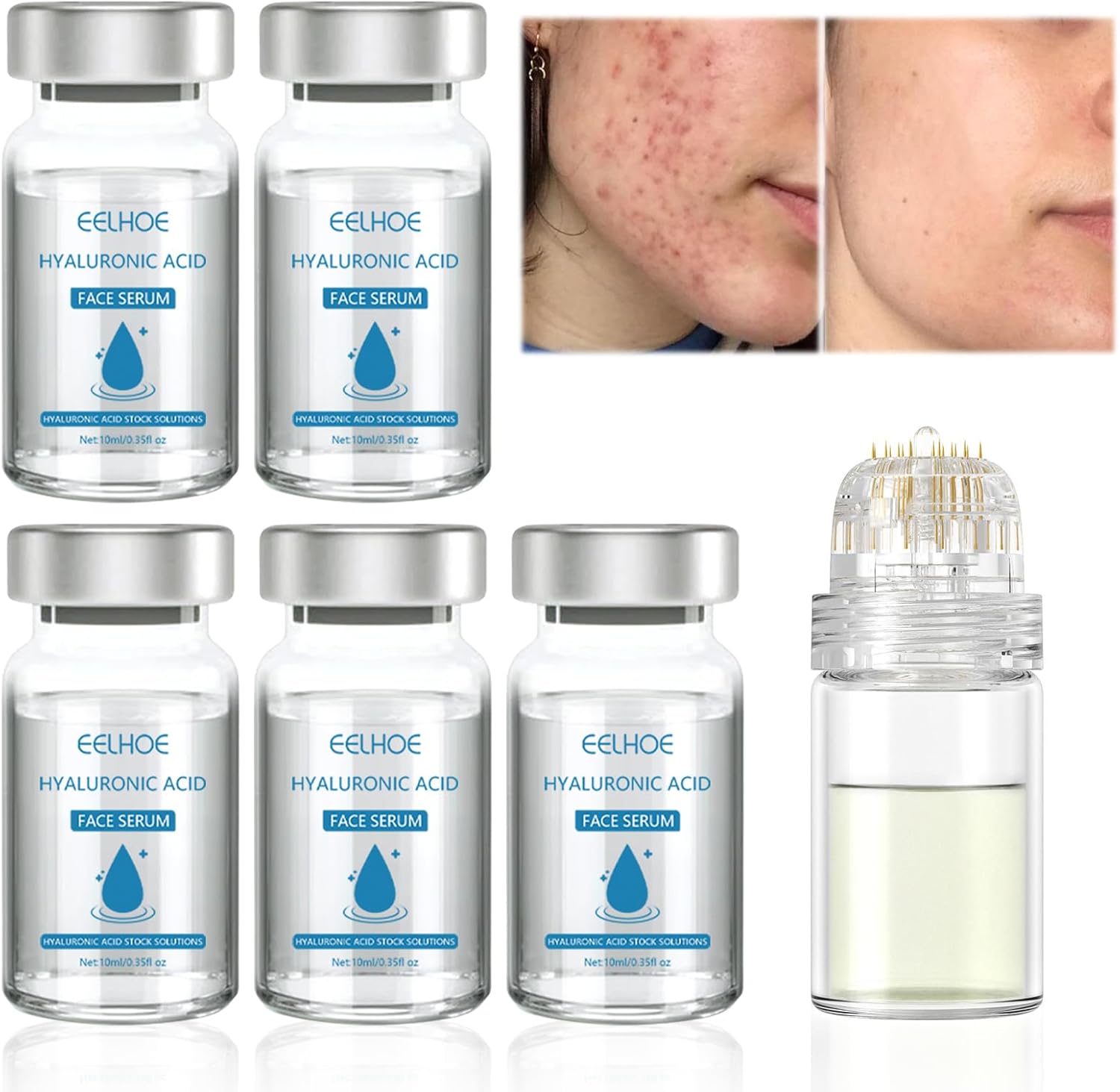 Gla-Mory Micro Infusion System for Lips,Micro Infusion Facial System,Gla-Mory Micro-Infusion Facial System,Repair Skin,Deep Nourishment,Suitable for All Skin Types (5 PCS Serum with Roller)