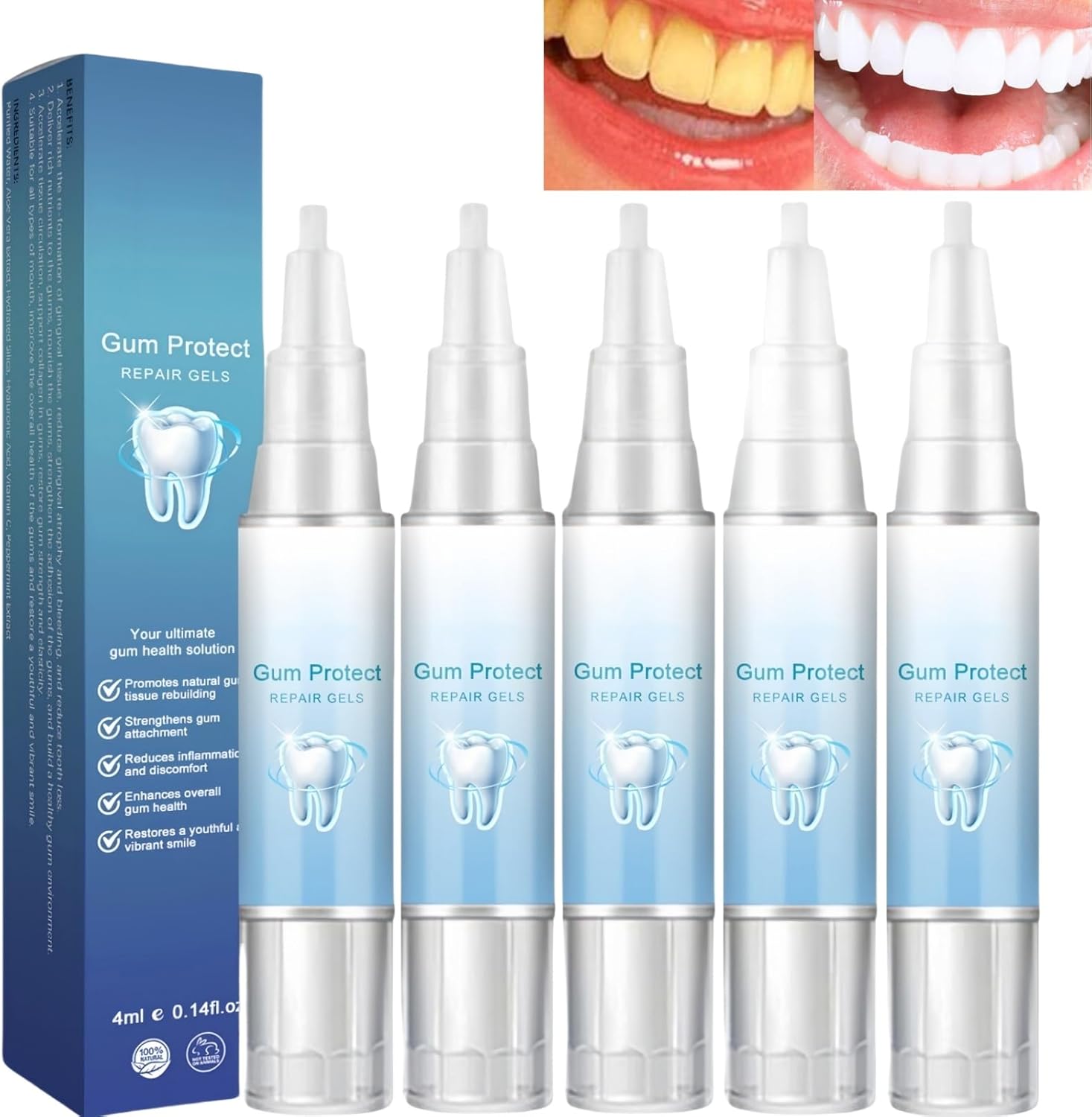 5PCS Gum Repair Gel Treatment,Gum Shield Gel,Teeth Repair ge/l,Oral Care for Teeth Pen,Teeth Whitening Essence Pen,Revitalizes G/ums for Tee/th,Instant Tee/th Treatment Essence Pe/n