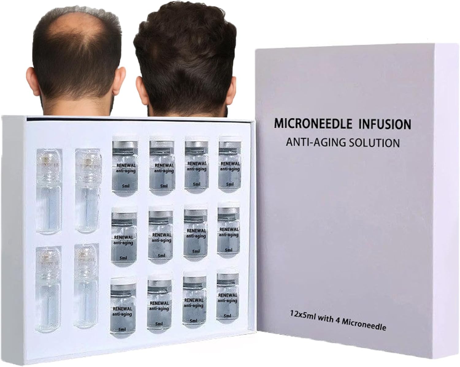 Hair Regrowth System - Microneedle Infusion Hair Regrowth Solution, Painless Micro-Infusion Technology, 100% Natural Ingredient Serum, Reactivates Hair Growth in 1 Week